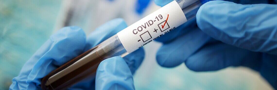 Ситуація з COVID-19 на Житомирщині: зафіксовано поодинокі випадки, зокрема, у Звягельському районі 