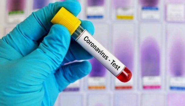 COVID-19 на Житомирщині: минулого тижня захворюваність знизилася на 30%