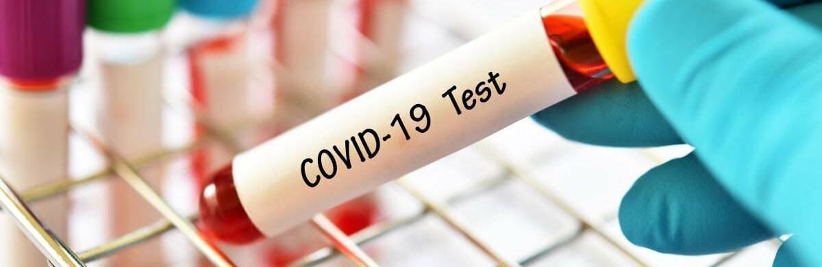 На Житомирщині знизилася захворюваність на COVID-19 - епідеміологи