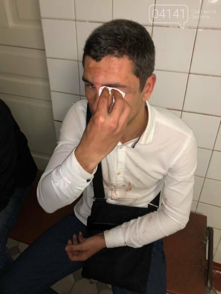 Новоград Радикальний: Скоєно напад на керівника молодіжного..., фото-1 Новоград Радикальний: Скоєно напад на керівника молодіжного крила (ФОТО), фото-1