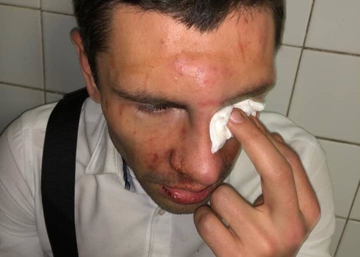 Новоград Радикальний: Скоєно напад на керівника молодіжного крила Новоград Радикальний: Скоєно напад на керівника молодіжного крила, Олександр Сукач