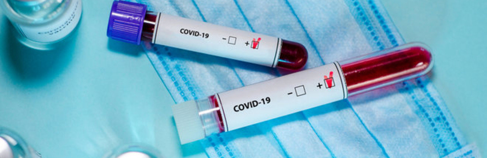 coronavirus coronavirus, Ірина Сукач